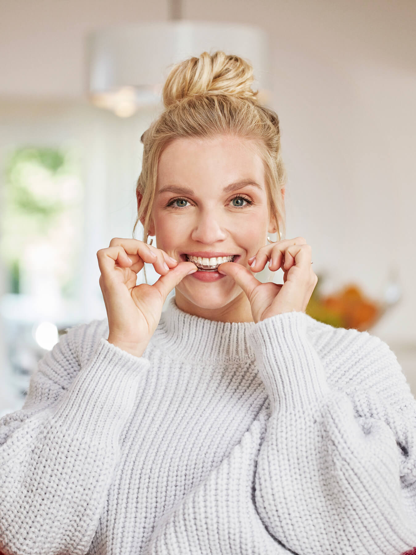 The Unique Benefits Of Angel Aligners The Unique Benefits Of Angel Aligners