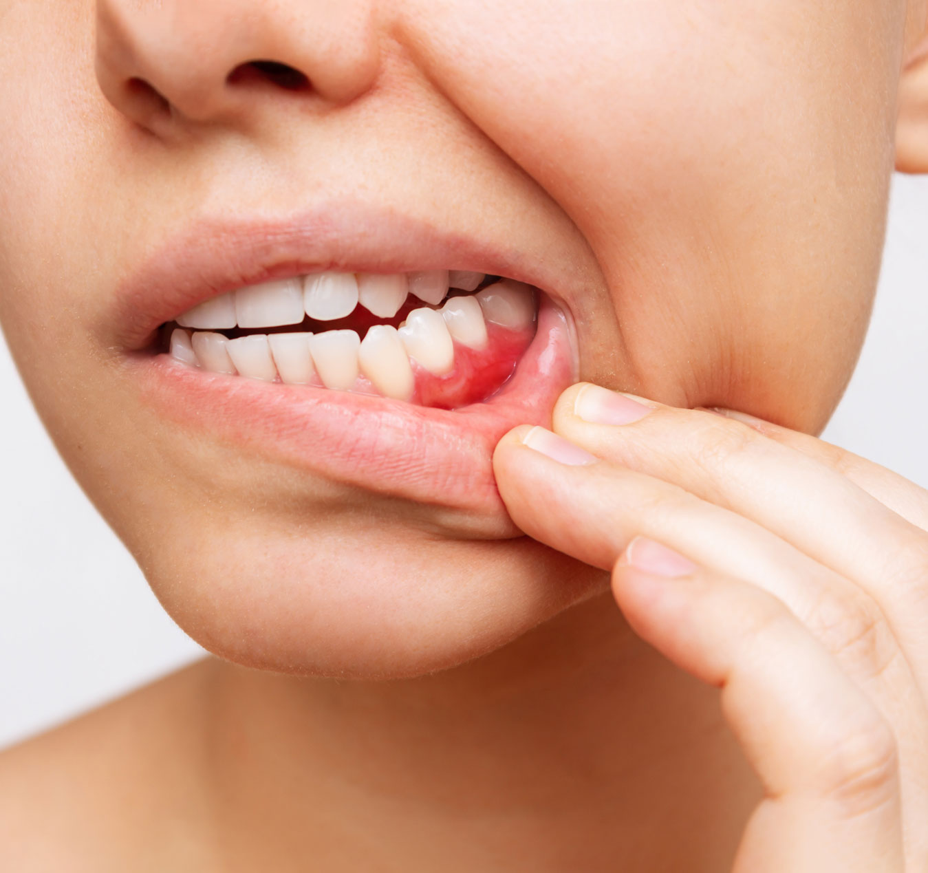 When Should You See a Periodontist?