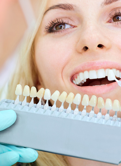 Crowns, Bridges & Veneers