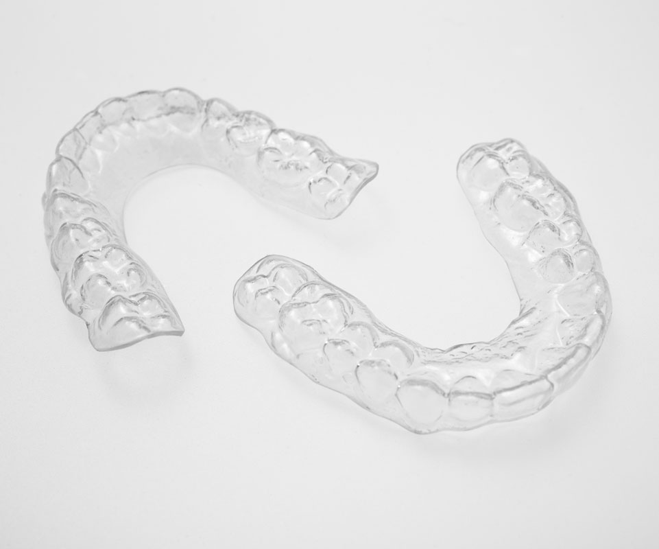 Invisalign® Vs Spark and Angel Aligners: Which Is Right For Your Smile?