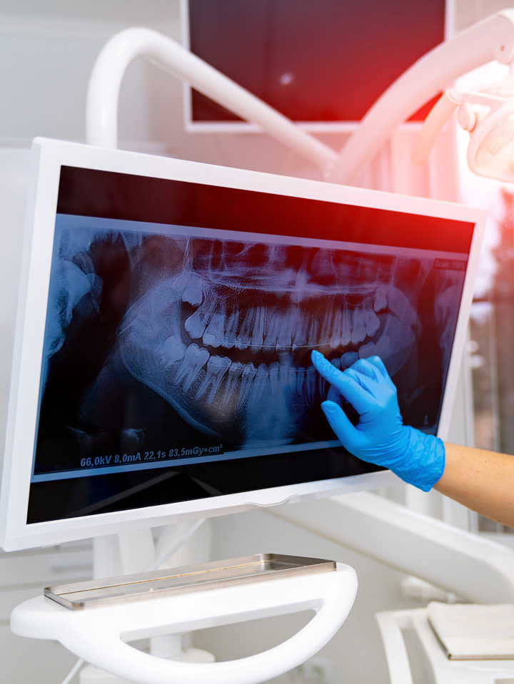 Oral Surgery Wisdom tooth removal & advanced dental procedures. Oral Surgery Wisdom tooth removal & advanced dental procedures.