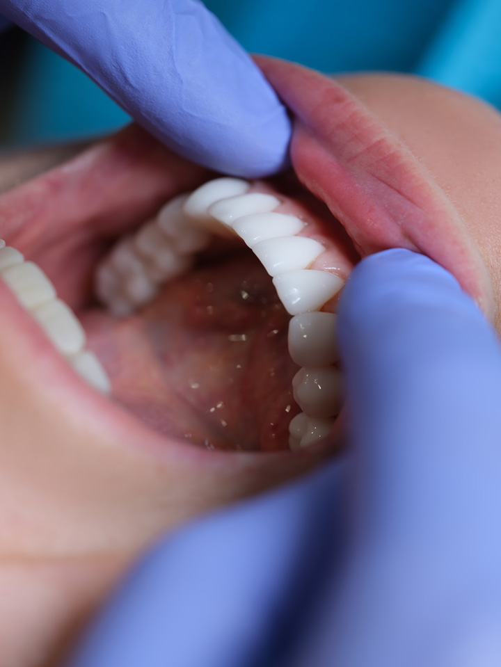 Hygiene Healthy teeth & gums with professional deep cleaning. Hygiene Healthy teeth & gums with professional deep cleaning.