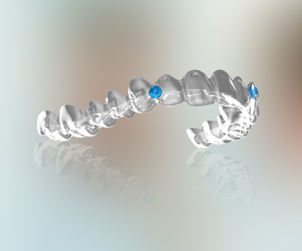 Angel Aligners Angel Aligners