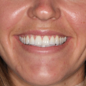 Smiling